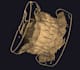 create accurate implant prosthesis designs using exocad