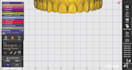 create accurate implant prosthesis designs using exocad