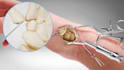 create 3d medical animation, healthcare explainer and scientific animation