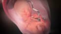 create 3d medical device animation and surgical procedure video