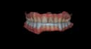 design a custom dental michigan night guard