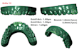 design custom gem set grillz cad from your teeth scan