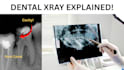 professionally read and explain your dental x rays