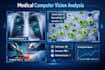 develop medical computer vision script for object, cell, and instrument counting