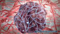 create 3d medical animation video, human anatomy, procedure, and explainer