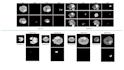 build medical imaging and computer vision models using deep learning