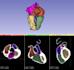 convert ct and mri scans into 3d printable medical models