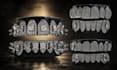 design any type of custom grillz and teeth jewellery design