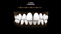 do 3d dental animation, 3d dentistry process, 3d medical animation