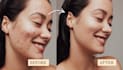 professionally retouch and edit skin