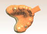design individual digital dental tray