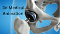 create 3d medical animation