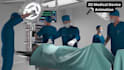 create 3d medical animation surgery explainer animation medical device animation