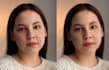 wrinkles blemishes dark circles and unwanted imperfections