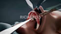 do 3d anatomy animation 3d surgery animation 3d medical device explainer video