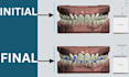 do dental clear aligner treatment planning on onyxceph and 3shape