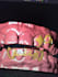 3d grillz designs, teeth jewelry, custome grillz teeth, teeth 3d model
