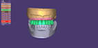 design dental prothesis all on using exocad