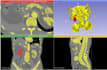 do ct and mri scans segmentation using 3d slicer