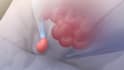 create realistic 3d surgical procedure animation surgical animation video