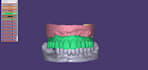 design dental prothesis all on using exocad