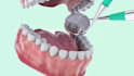 create professional 3d medical animation, surgery, and scientific visuals