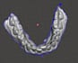 clean and optimize dental scans for 3d printing