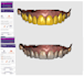 design dental mock ups