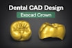 design dental crowns using exocad professionally