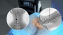 create professional 3d medical animation for orthopedic surgery and anatomy