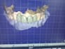 design high precision 3d dental models