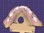 do exocad dental implant design fast and accurately