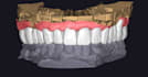 provide professional exocad dental design and 3d modeling services