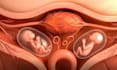 create 3d medical animation, anatomy animation, medical explainer video