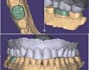 design your exocad crown accurately
