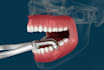 do 3d medical animation, surgical animation, explainer video, 3d medical device