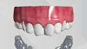 create 3d dental medical animation, 3d clear aligner simulation animation video