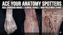 teach you anatomy spotters using real cadaveric image
