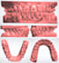 make clear aligner with 3shape