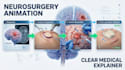 create 3d brain neurosurgery animation, medical anatomy
