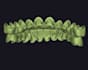 reliable dental cad cam outsourcing service