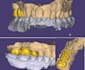 design professional dental crowns, bridges
