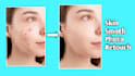 do skin retouching photo editing