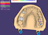 design dental crown and bridge using exocad