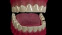 create 3d dental animation, medical animation, 3d dental explainer video