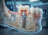 design high quality dental surgical 3d animations