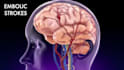do 3d medical animation neurology healthcare explainer video