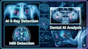 develop ai x ray mri dental image detection medical computer vision system