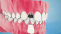 create realistic 3d dental impact and medical animation video