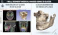 do medical image segmentation and 3d modeling using 3d slicer